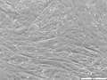 File:-Adrenergic-Inhibition-of-Contractility-in-L6-Skeletal-Muscle-Cells-pone.0022304.s002.ogv
